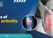 causes of septic arthritis