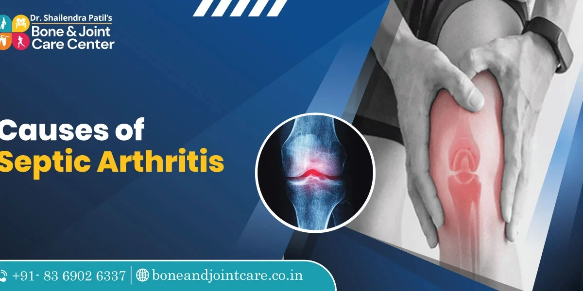 causes of septic arthritis