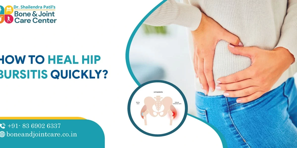 How to heal hip bursitis quickly
