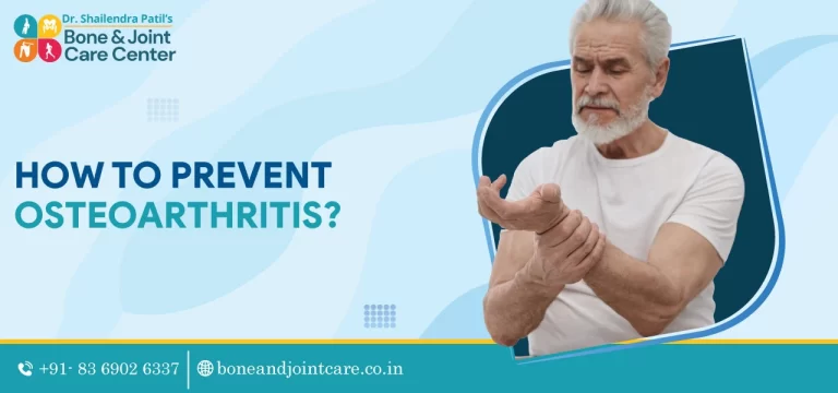 how to prevent osteoarthritis