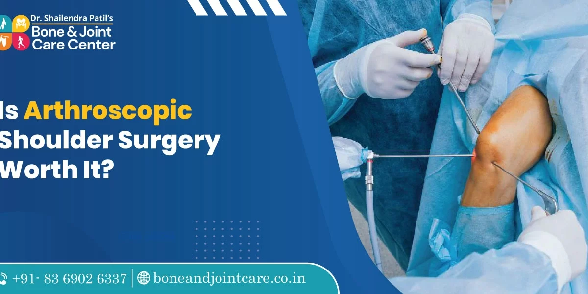 is arthroscopic shoulder surgery worth it