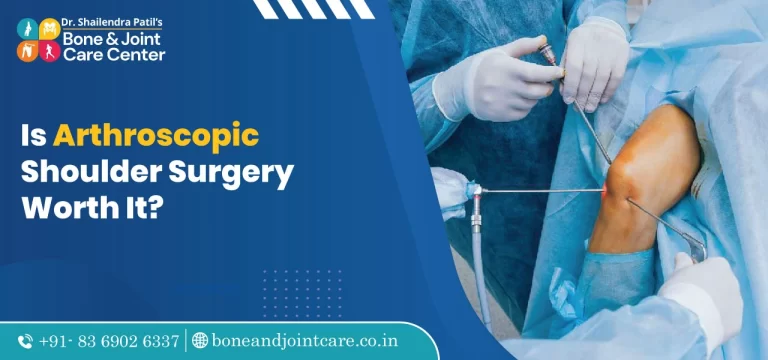 is arthroscopic shoulder surgery worth it