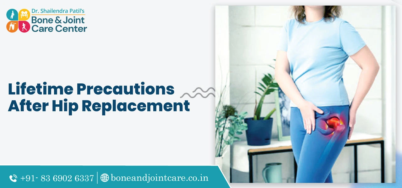 lifetime precautions after hip replacement