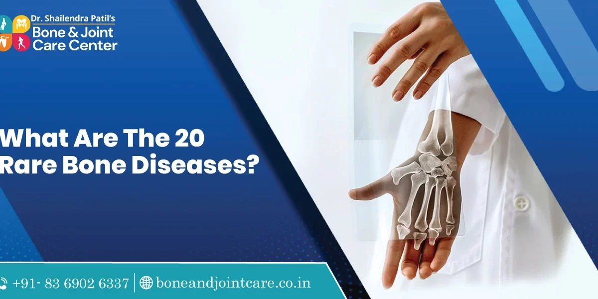 what are the 20 rare bone diseases