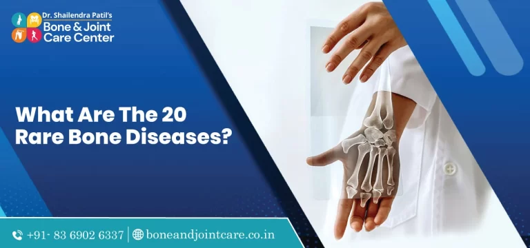 what are the 20 rare bone diseases