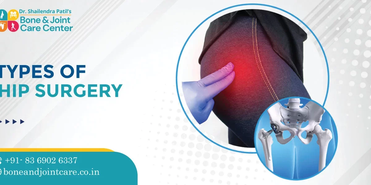 Types of Hip Surgery