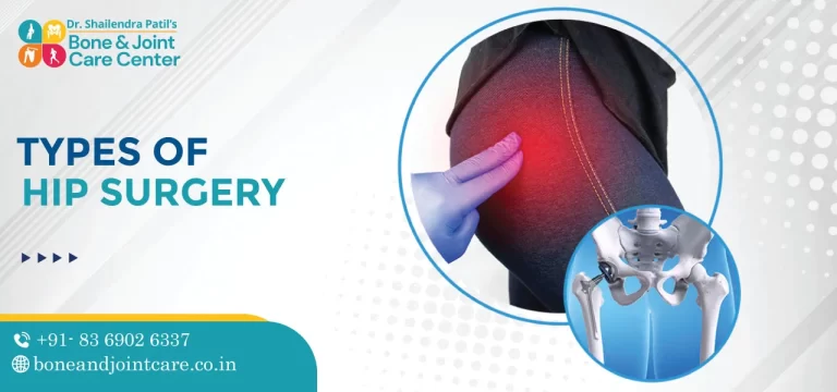 Types of Hip Surgery