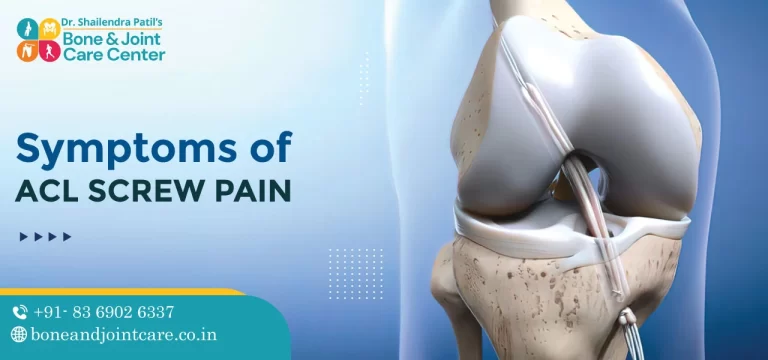 Symptoms of ACL Screw Pain