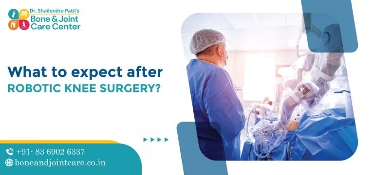 What to Expect After Robotic Knee Surgery
