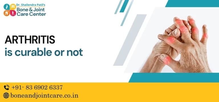 Is Arthritis Curable or Not