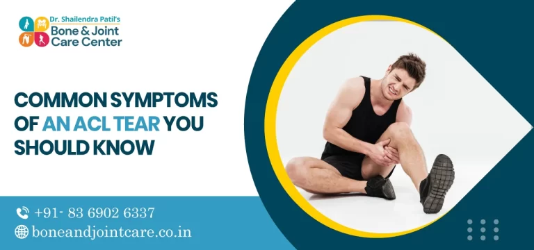 Common Symptoms of an ACL Tear You Should Know