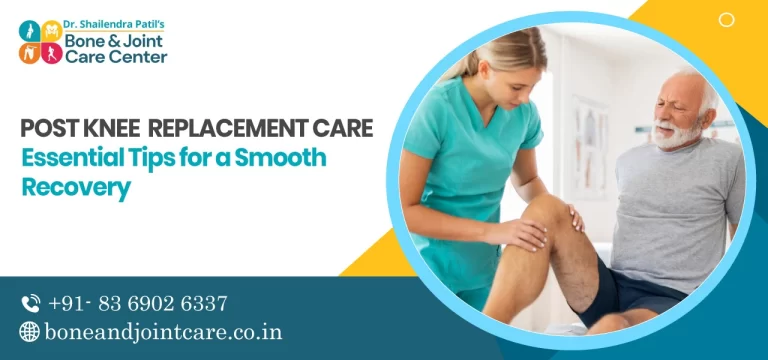Post Knee Replacement Care: Essential Tips for a Smooth Recovery