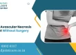 Exploring Avascular Necrosis Treatment Without Surgery