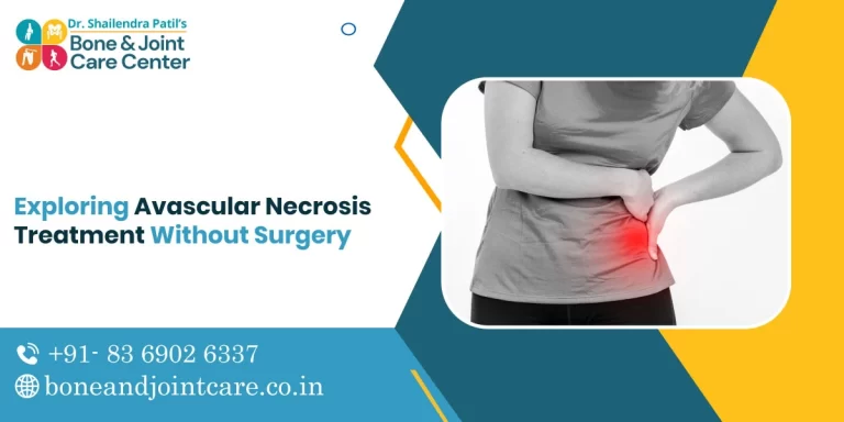 Exploring Avascular Necrosis Treatment Without Surgery