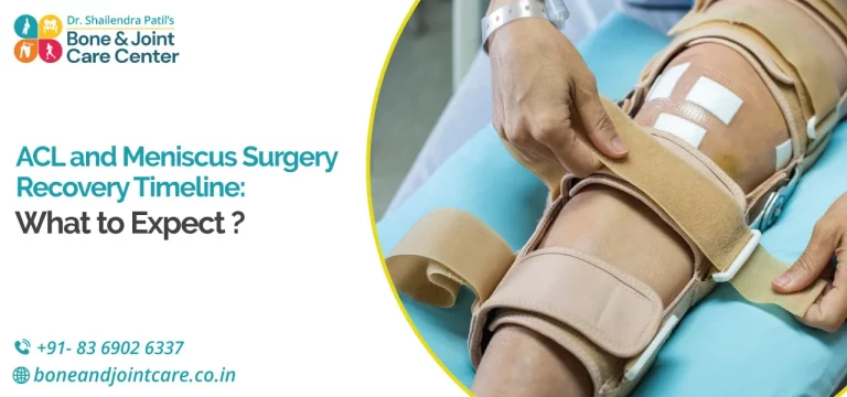 ACL and Meniscus Surgery