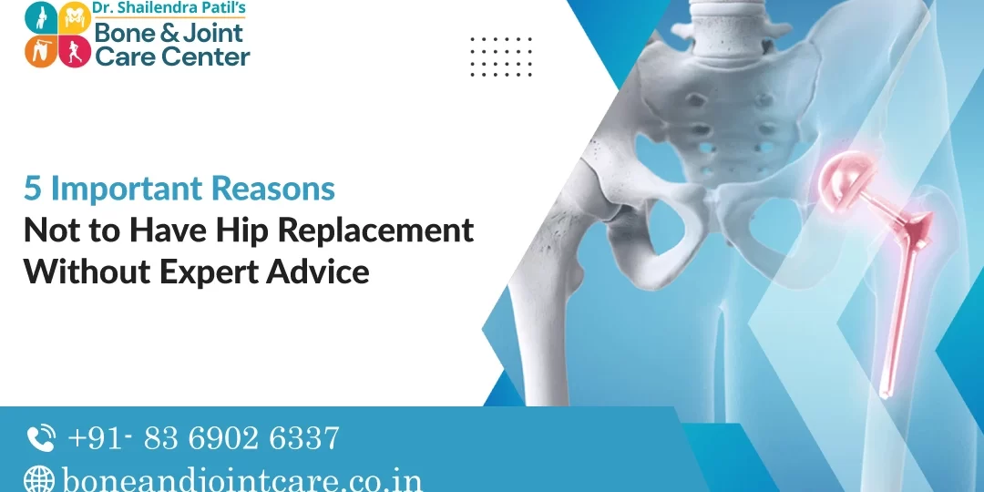 5 Important Reasons Not to Have Hip Replacement Without Expert Advice