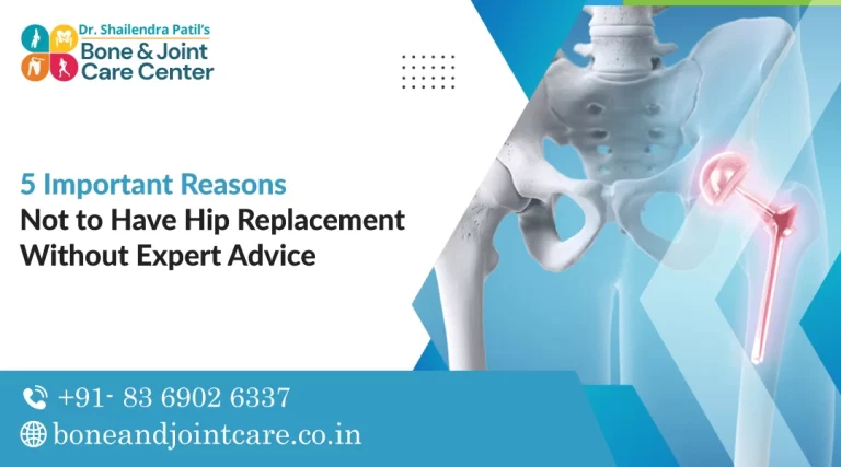 5 Important Reasons Not to Have Hip Replacement Without Expert Advice