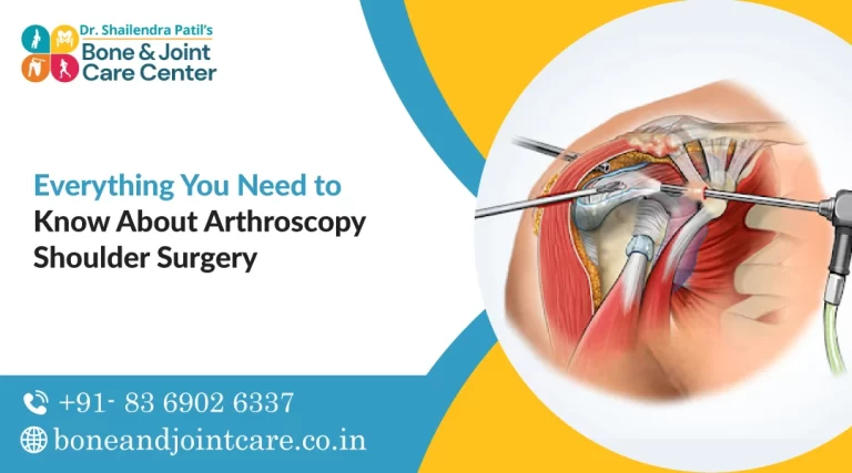 Everything You Need to Know About Arthroscopy Shoulder Surgery