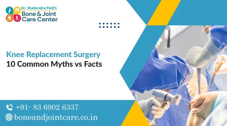 10 Common Myths vs Facts about Knee Replacement