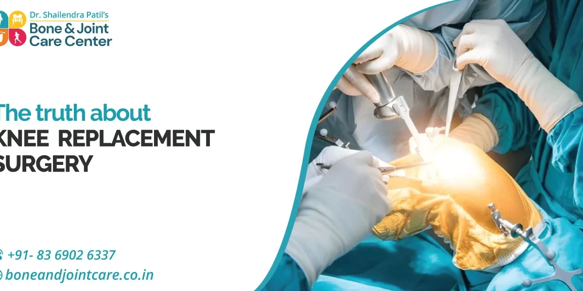 The Truth about Knee Replacement Surgery