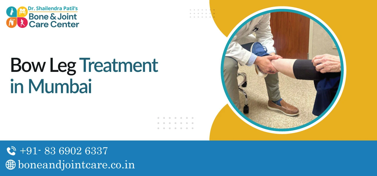 Bow Leg Treatment in Mumbai
