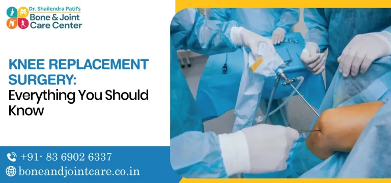 Knee Replacement Surgery: Everything You Should Know