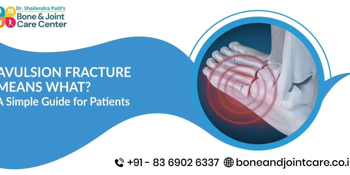 Avulsion Fracture Means What? A Simple Guide for Patients