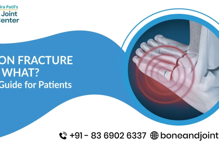 Avulsion Fracture Means What? A Simple Guide for Patients