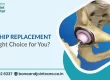 Ceramic Hip Replacement: Is It the Right Choice for You?