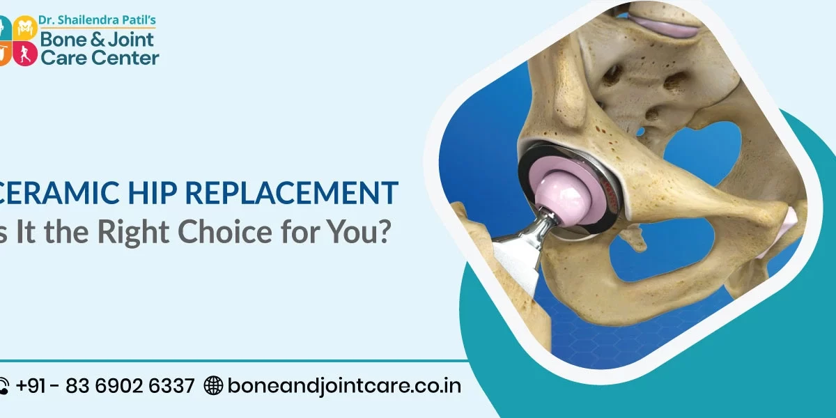 Ceramic Hip Replacement: Is It the Right Choice for You?
