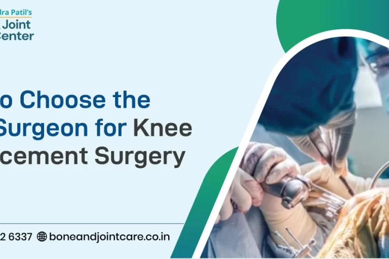 How to Choose the Best Surgeon for Knee Replacement Surgery