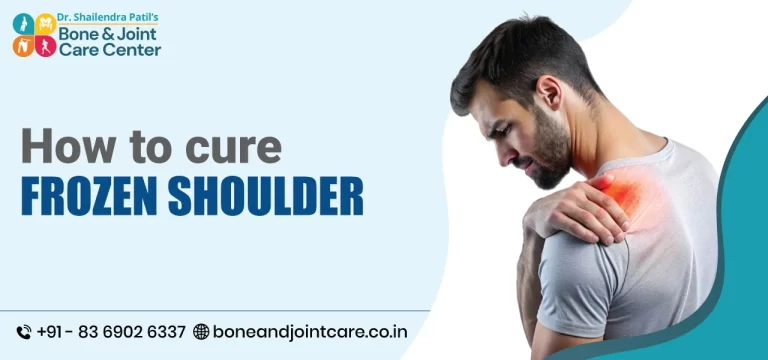 How to Cure Frozen Shoulder