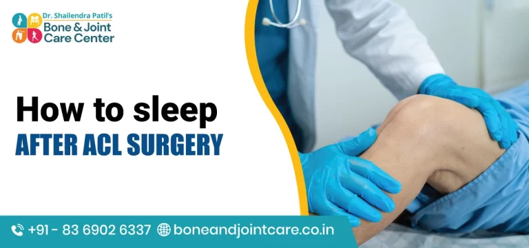 How to Sleep After ACL Surgery​