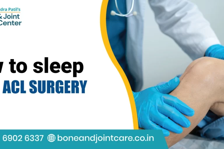 How to Sleep After ACL Surgery​