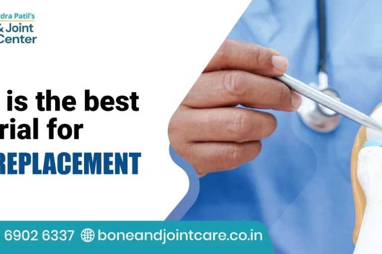 What is the Best Material for Knee Replacement