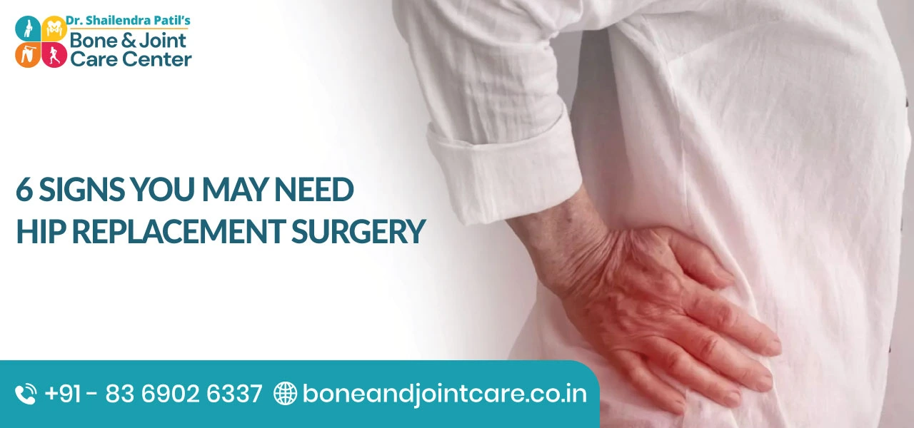 6 Signs You May Need Hip Replacement Surgery