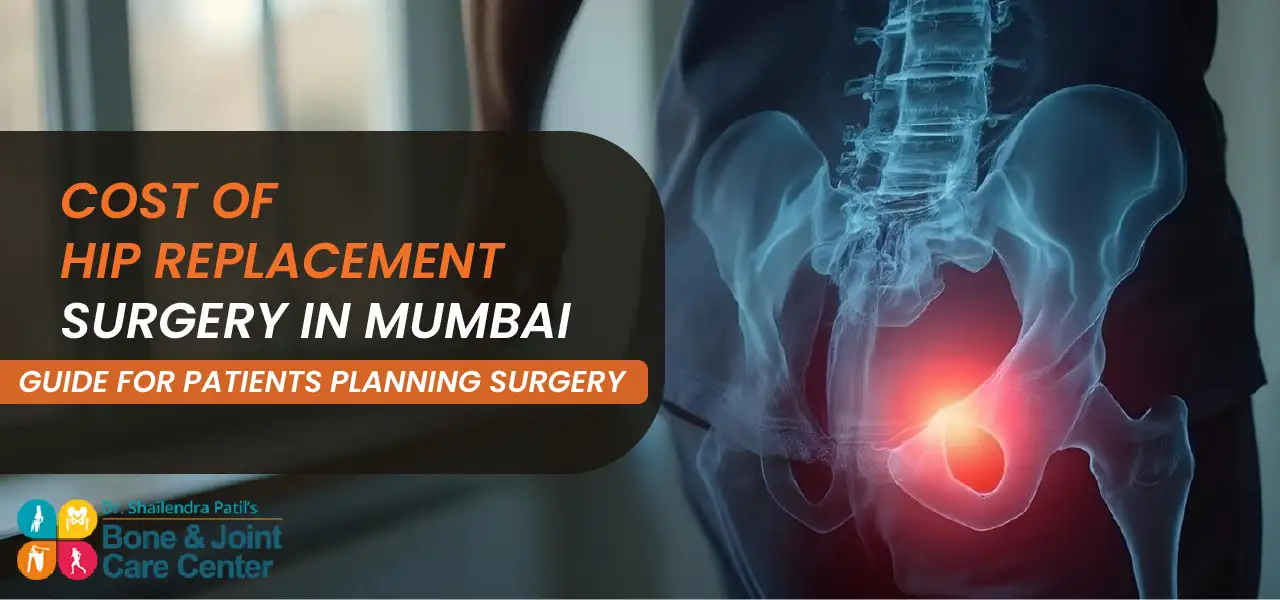 Cost of Hip Replacement Surgery in Mumbai