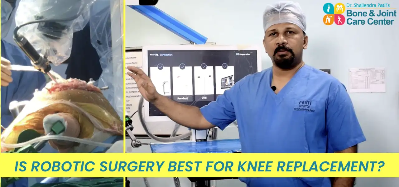 is robotic surgery best for knee replacement