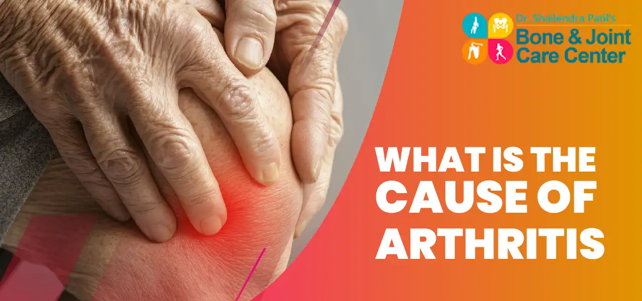 what is the cause of arthritis