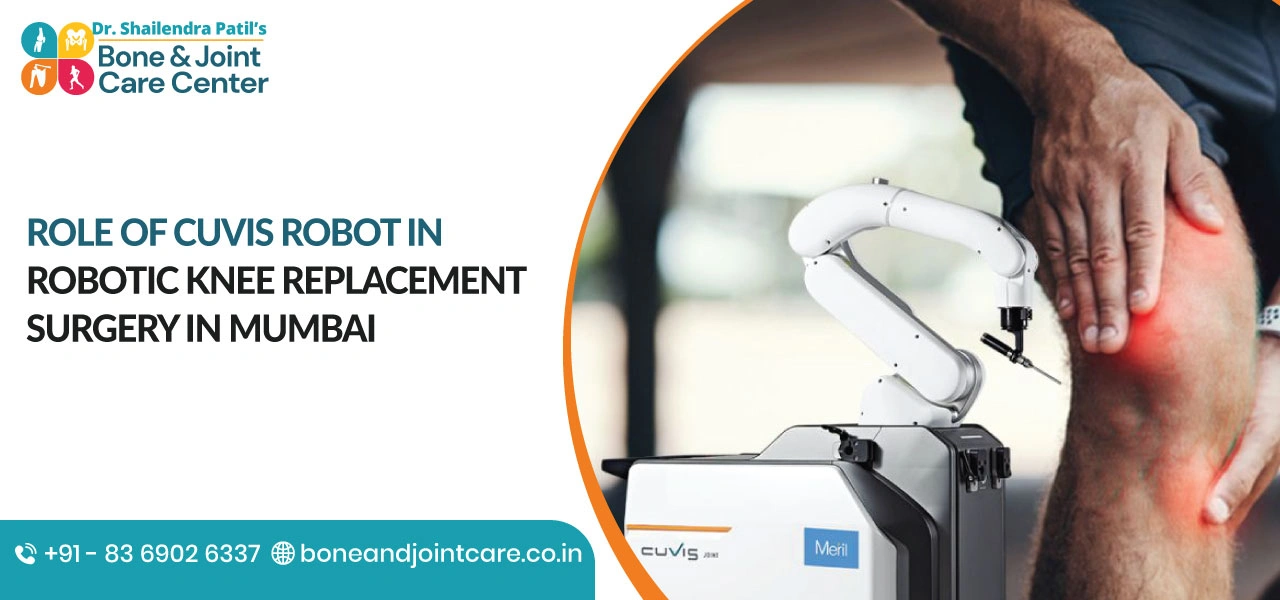 Role of CUVIS Robot in Robotic Knee Replacement Surgery in Mumbai