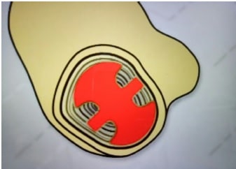 stem-shape
