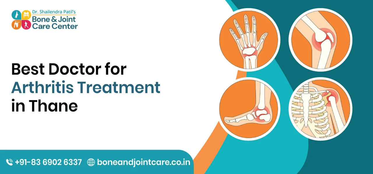 Best Doctor for Arthritis Treatment in Thane