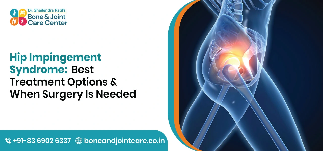 Hip Impingement Syndrome