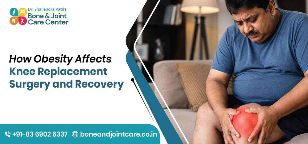 How Obesity Affects Knee Replacement Surgery and Recovery