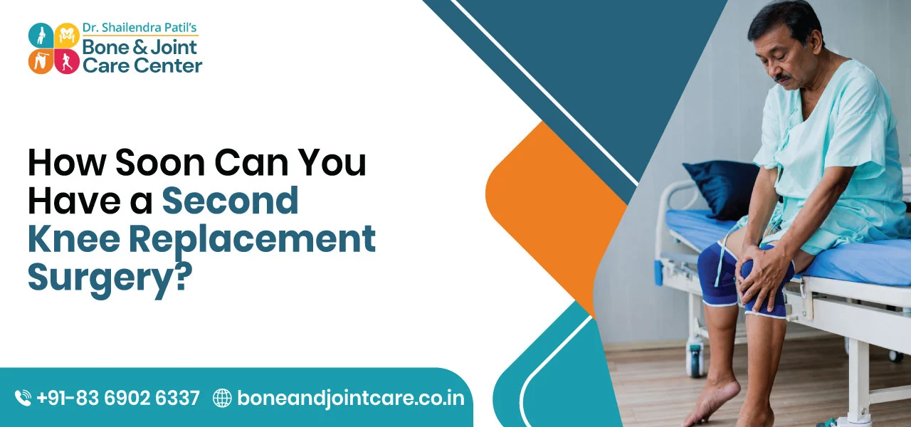 How Soon Can You Have a Second Knee Replacement Surgery?